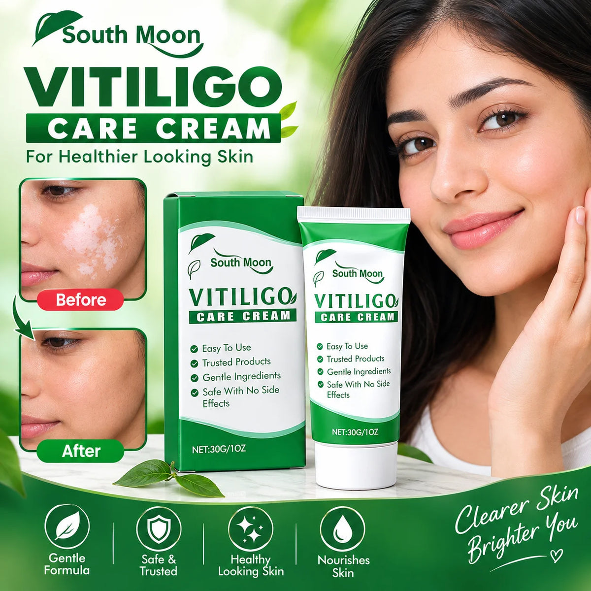 Vitiligo Care Cream
