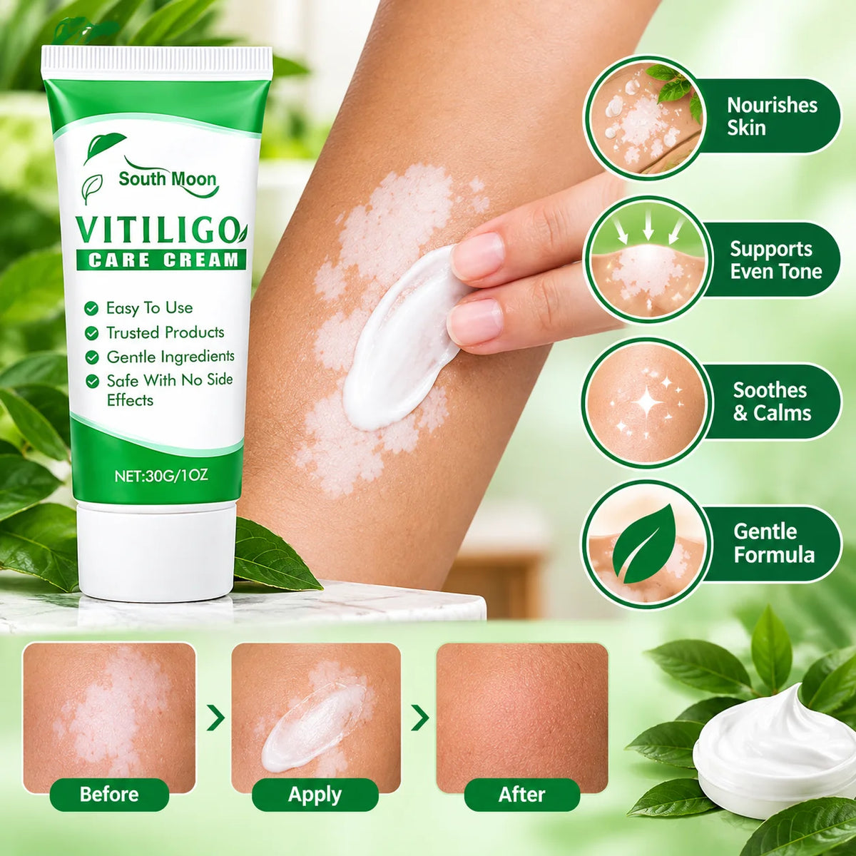 Vitiligo Care Cream