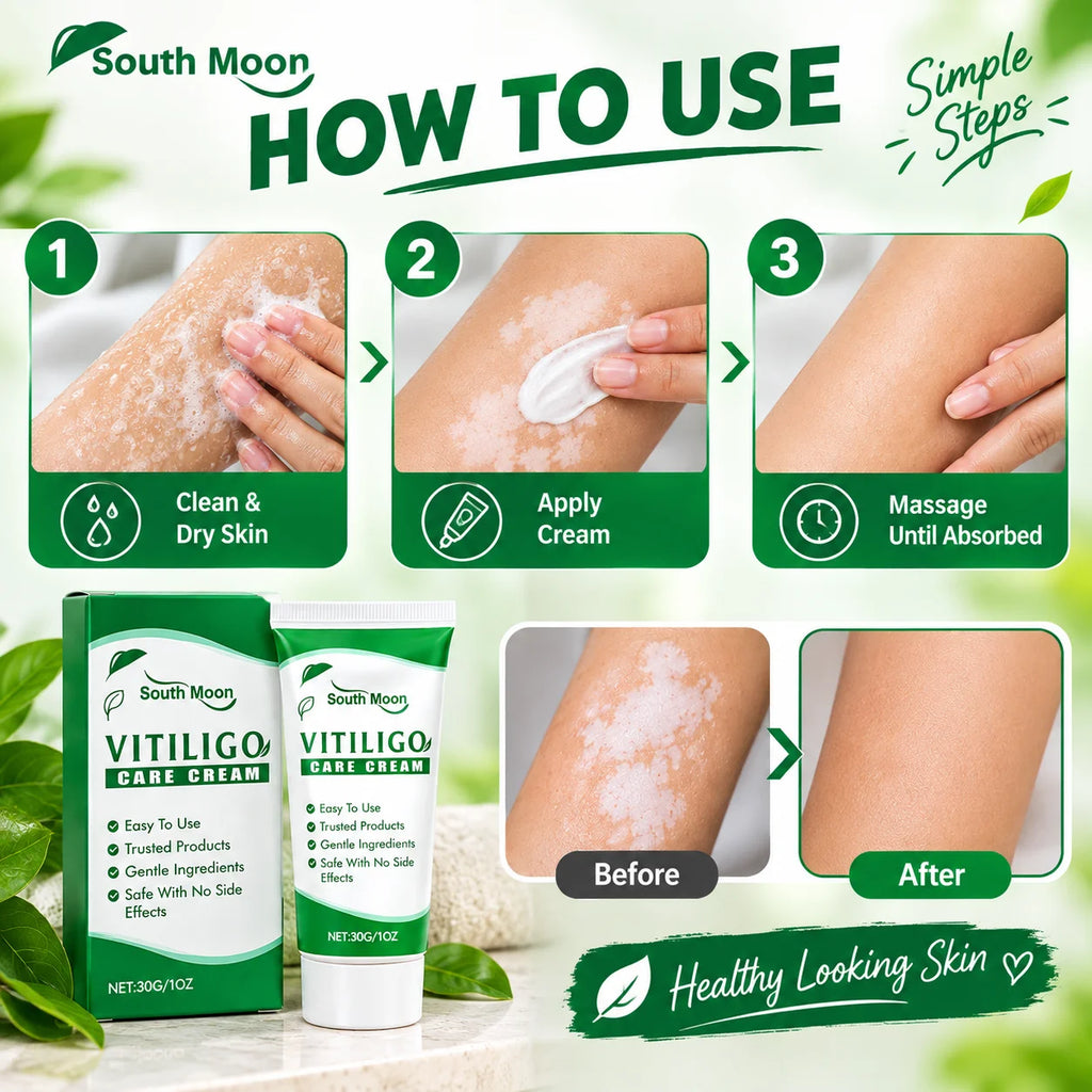 Vitiligo Care Cream