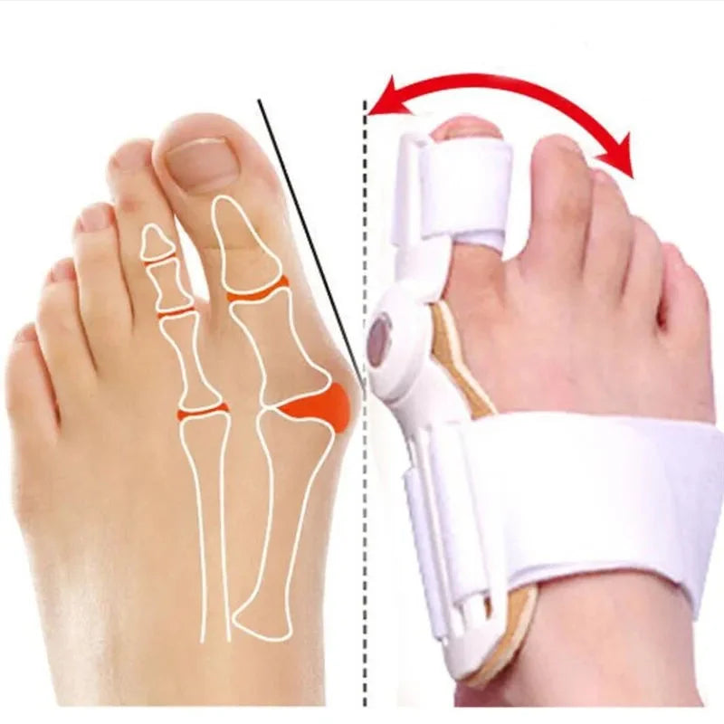 Bunion Aid Hinged Splint