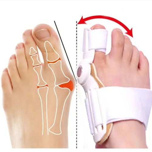Bunion Aid Hinged Splint